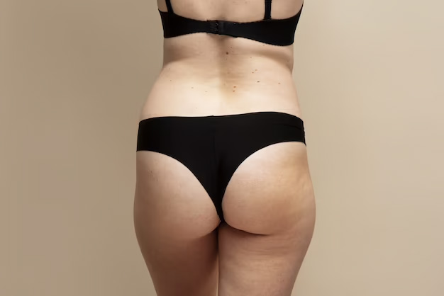 buttlift